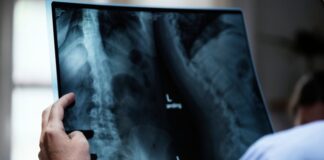 ماذا تعرف عن الآشعة السينية؟