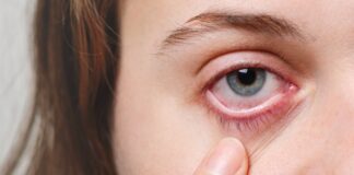 ما هي أعراض ضغط العين؟